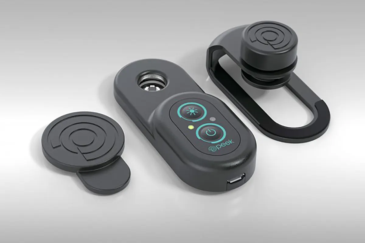 Mobile Ophthalmoscope